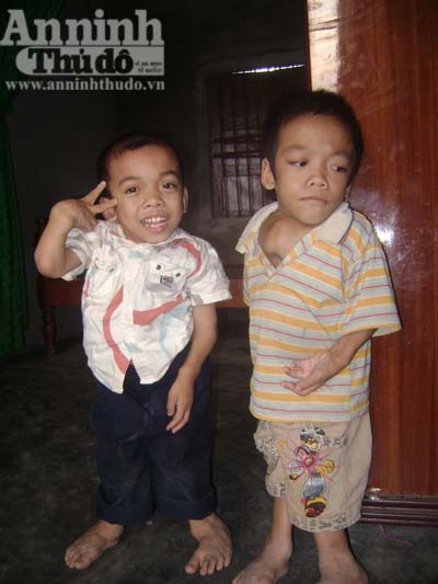 Nghị lực phi thường của “anh em tí hon”