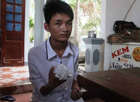 Bị tai nạn cụt 4 ngón tay phải, vẫn tự tin làm bài thi Bị tai nạn cụt 4 ngón tay phải, vẫn tự tin làm bài thi